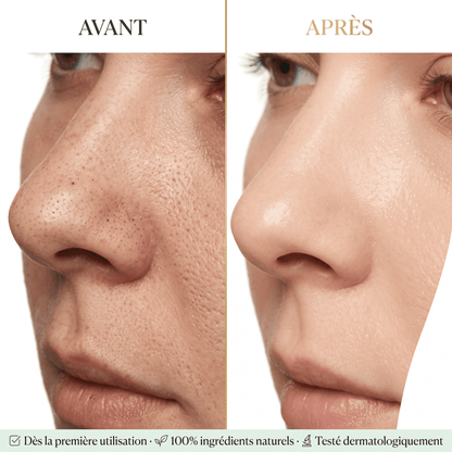 Peel Shot Éclat — Exfoliant Enzymatique au Riz