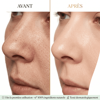 Sérum Anti-Points Noirs