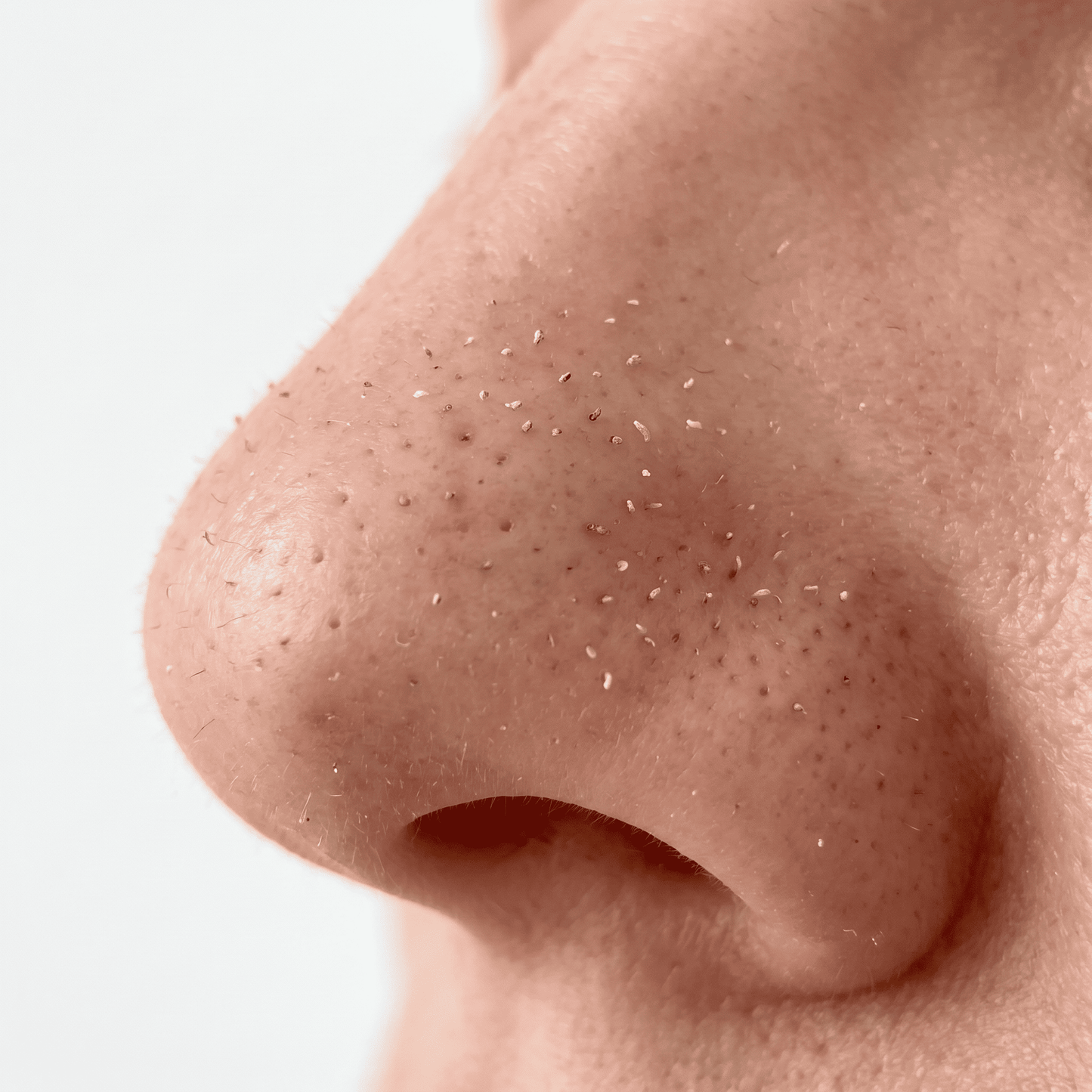 Peel Shot Éclat — Exfoliant Enzymatique au Riz